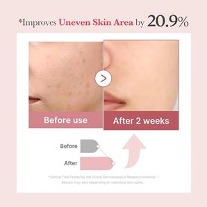 سرم اگزوزم کلاژن صورتی پی دی آر ان ۷۵۰۰ مدی کیوب