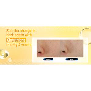 کرم ضد لک و روشن کننده گلوتاتیون نامبوزین شماره 5